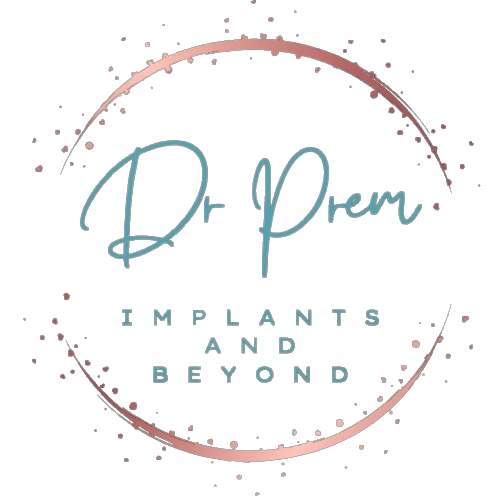 The Comprehensive Guide to Dental Implants: Regaining Your Smile and Confidence (DOCTORPREM)