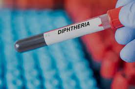 Diphtheria Outbreak in Pakistan News