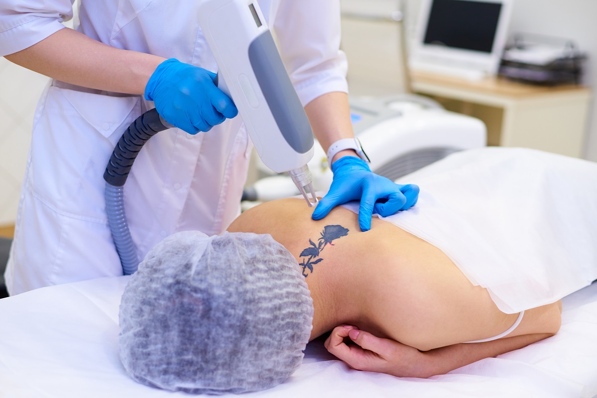 Are there any risks associated with Picosure Tattoo Removal