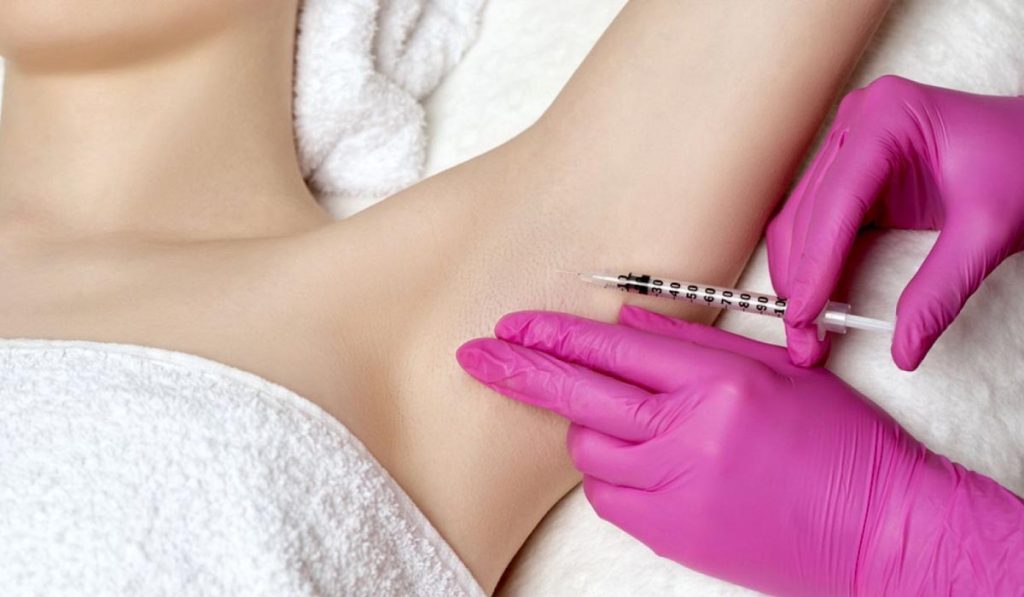 What Are the Benefits of Using Botox for Sweat Gland in Dubai?