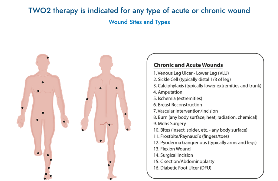 Non-Healing Wounds: Unlocking Solutions for Lasting Recovery