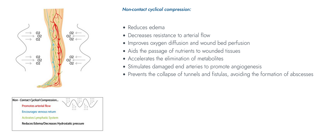 Stasis Ulcers: Managing Challenges in Circulatory Health